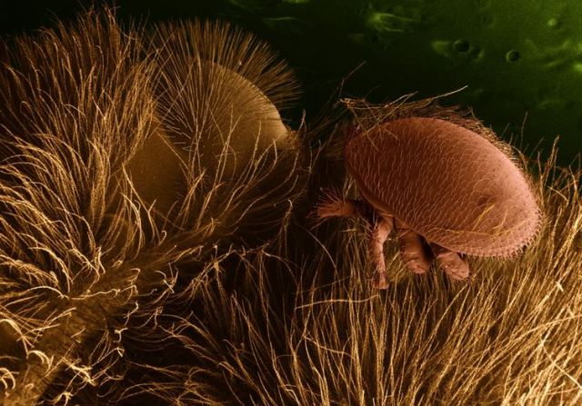 Varroa destructor on a honey bee, photographed by USDA Ag Research Service, using an electron microscope.